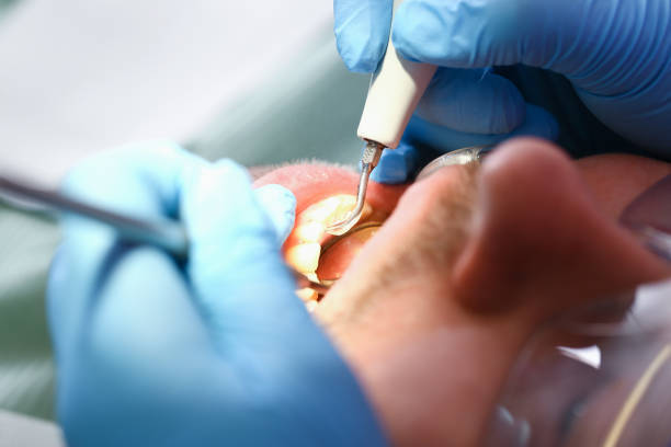 Best Emergency Cosmetic Dentistry in Unionville, NC