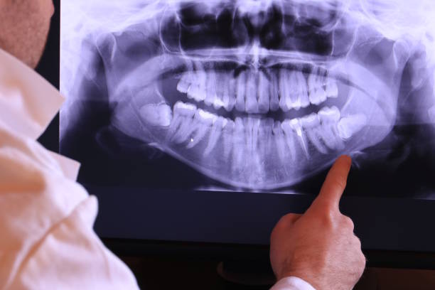 Best Broken or Cracked Tooth Emergency Dentist in Unionville, NC